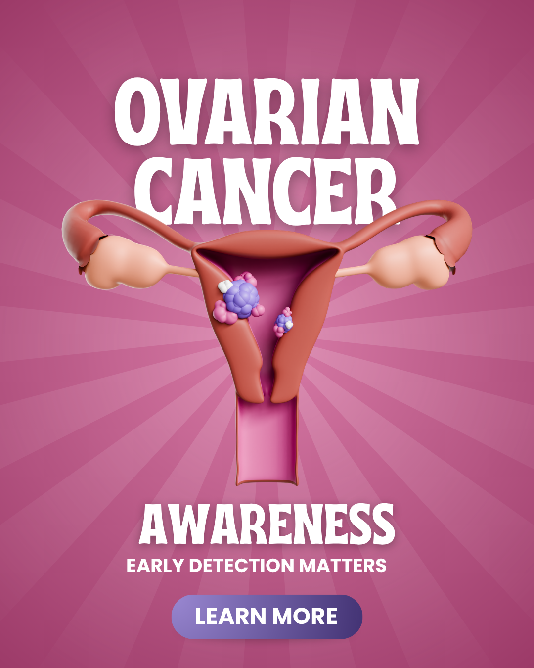 Ovarian Cancer: What African Women Over 35 Need to Stop Ignoring